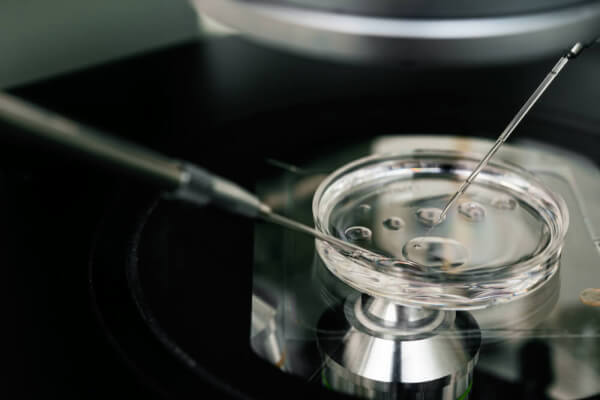 FIV para quem realizou métodos contraceptivos definitivos