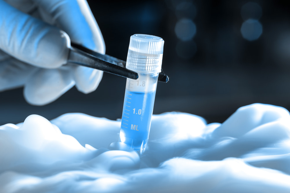 Transferência de embriões congelados: quais as vantagens?