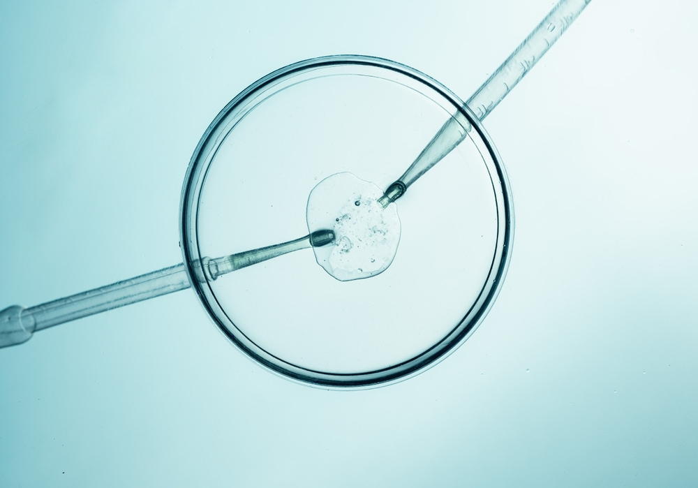 Existe limite para as tentativas de Fertilização in Vitro?