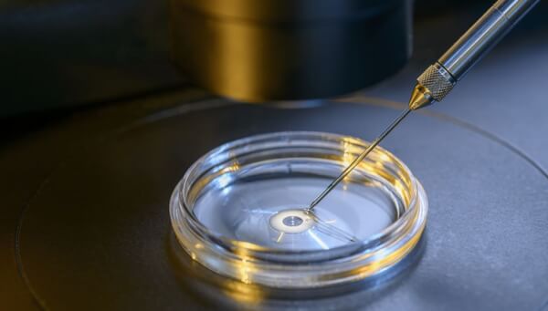 O que é FIV simplificada – saiba como funciona o procedimento