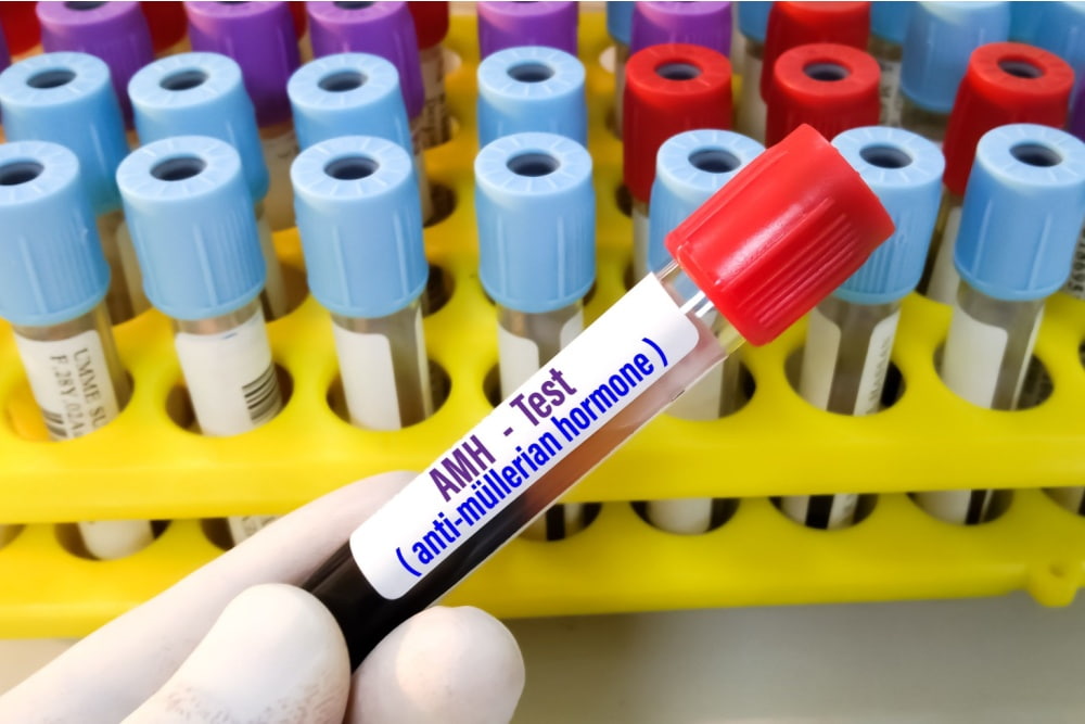 Hormônio antimülleriano: o que é e sua importância
