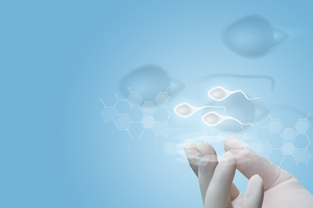 Microdeleção do cromossomo Y: o que é e o impacto na fertilidade