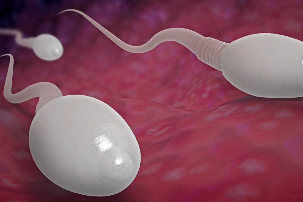 O que é a teratozoospermia?