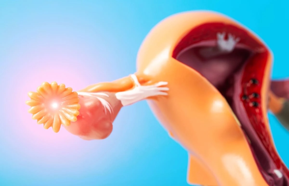 Salpingite: o que é, sintomas e relação com infertilidade