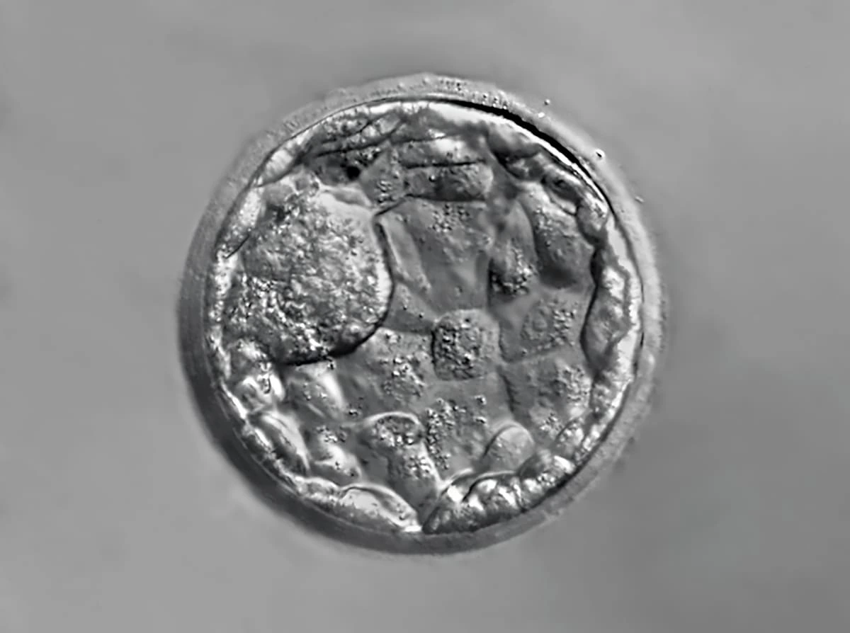 O que é blastocisto?