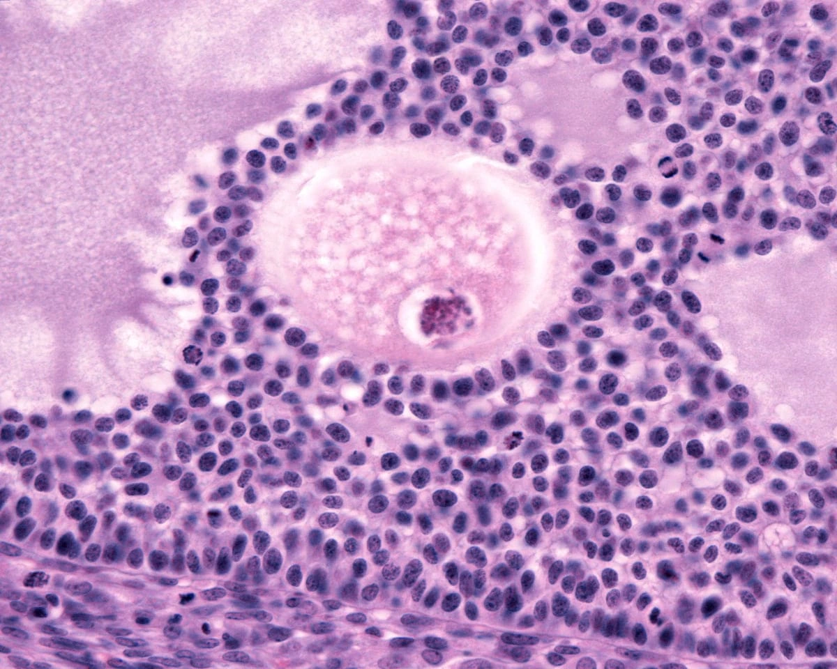 Folículos ovarianos: o que são e qual a relação com a fertilidade feminina