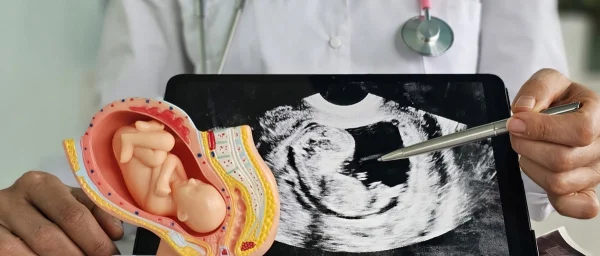 Fertilização in vitro e câncer infantil: o que realmente se sabe sobre essa relação?